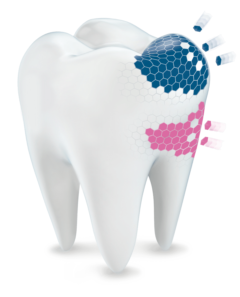 dente con particelle di smalto evidenziate