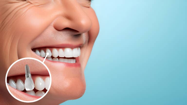 foto bocca sorridente di un adulto con impianto dentale